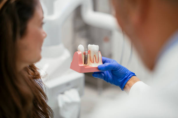 a dentist demonstrating a dental implant to a woman